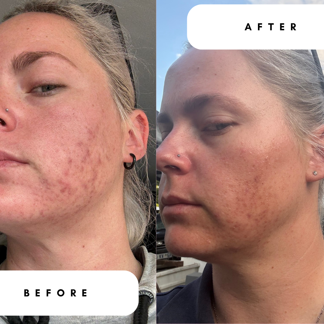 AHA Lactic Acid 5% Toner with Allantoin for Dark Marks