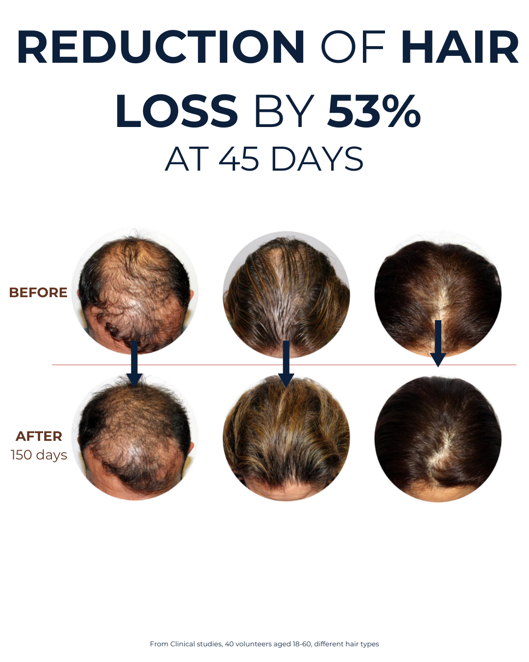 5-Months-Supply | Peptide Hair Growth Serum with Rosemary Extract & Plant-Stem-Cells