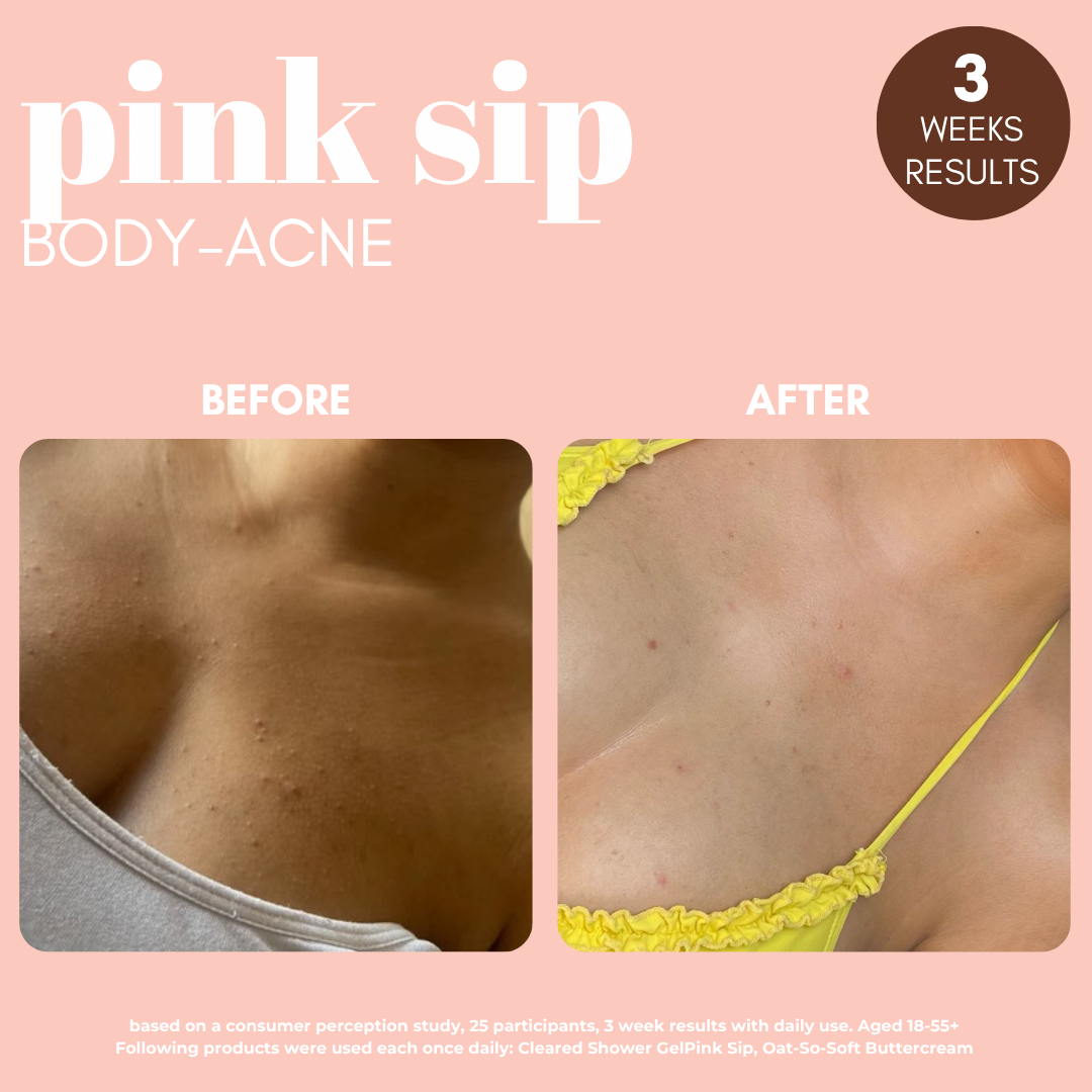Pink Sip Body Mist with Rose Water & 2% Salicylic Acid