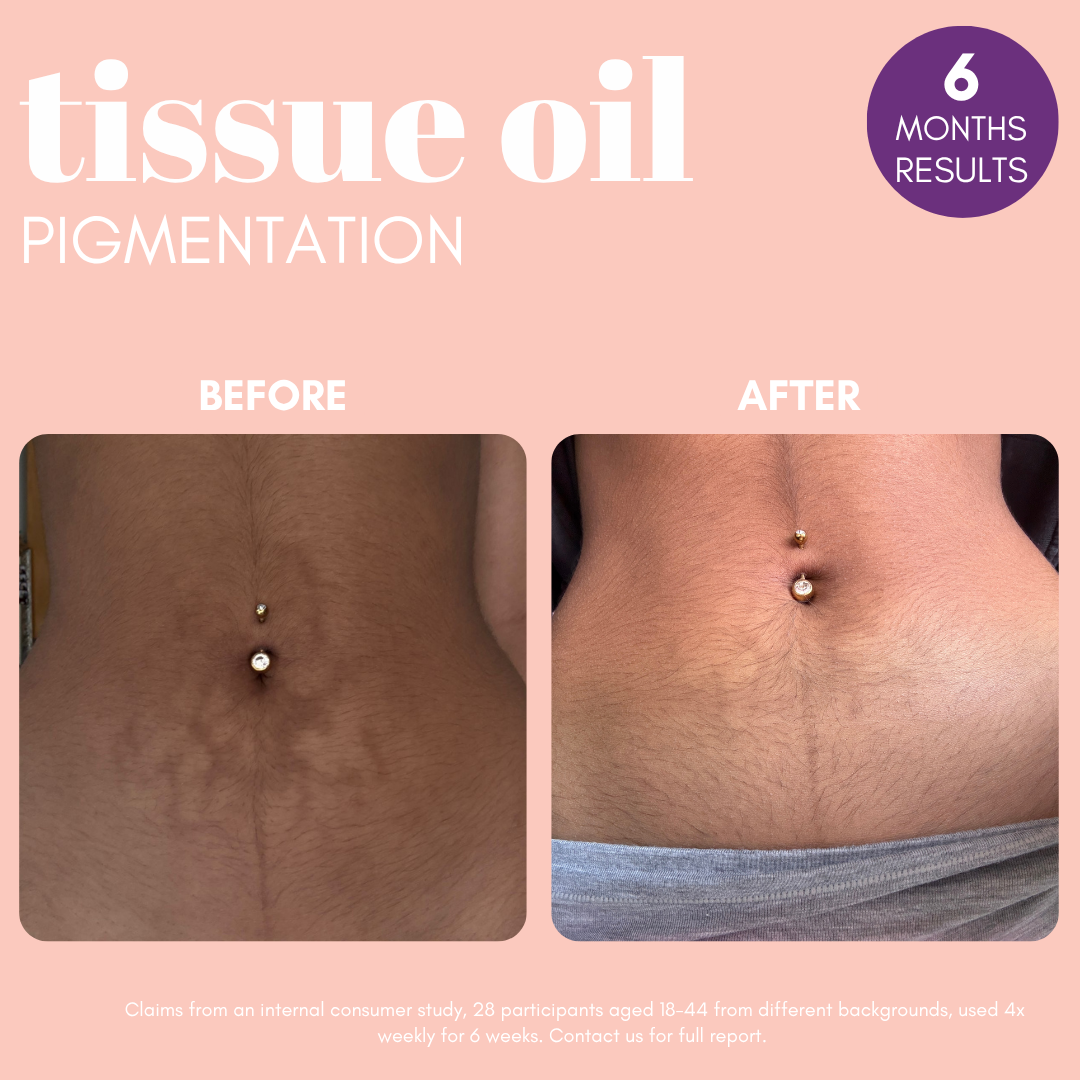 Pigmentation Buster ™ Tissue Oil with Bright Oleoactif® & VF Lino®