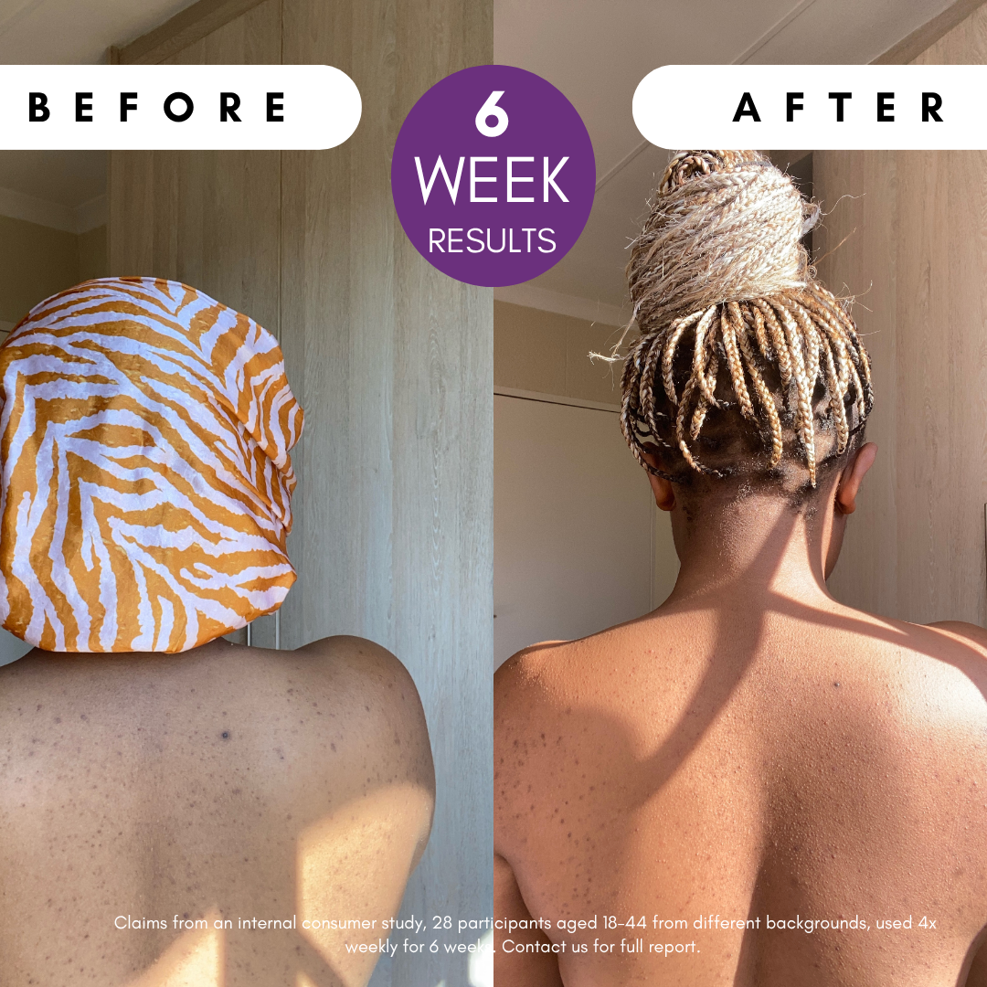 Pigmentation Buster ™ Tissue Oil with Bright Oleoactif® & VF Lino®