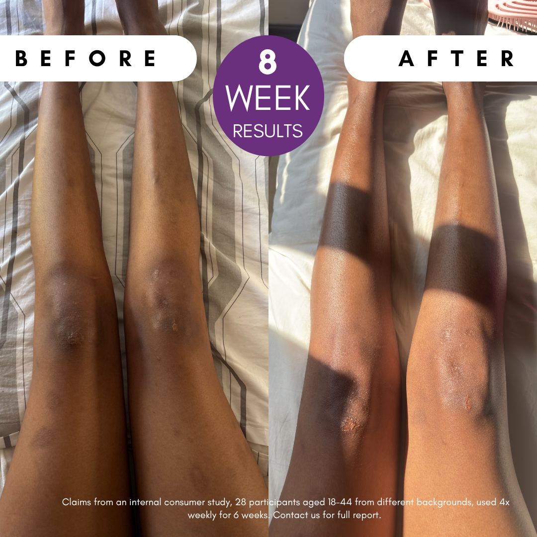 Pigmentation Buster ™ Tissue Oil with Bright Oleoactif® & VF Lino®