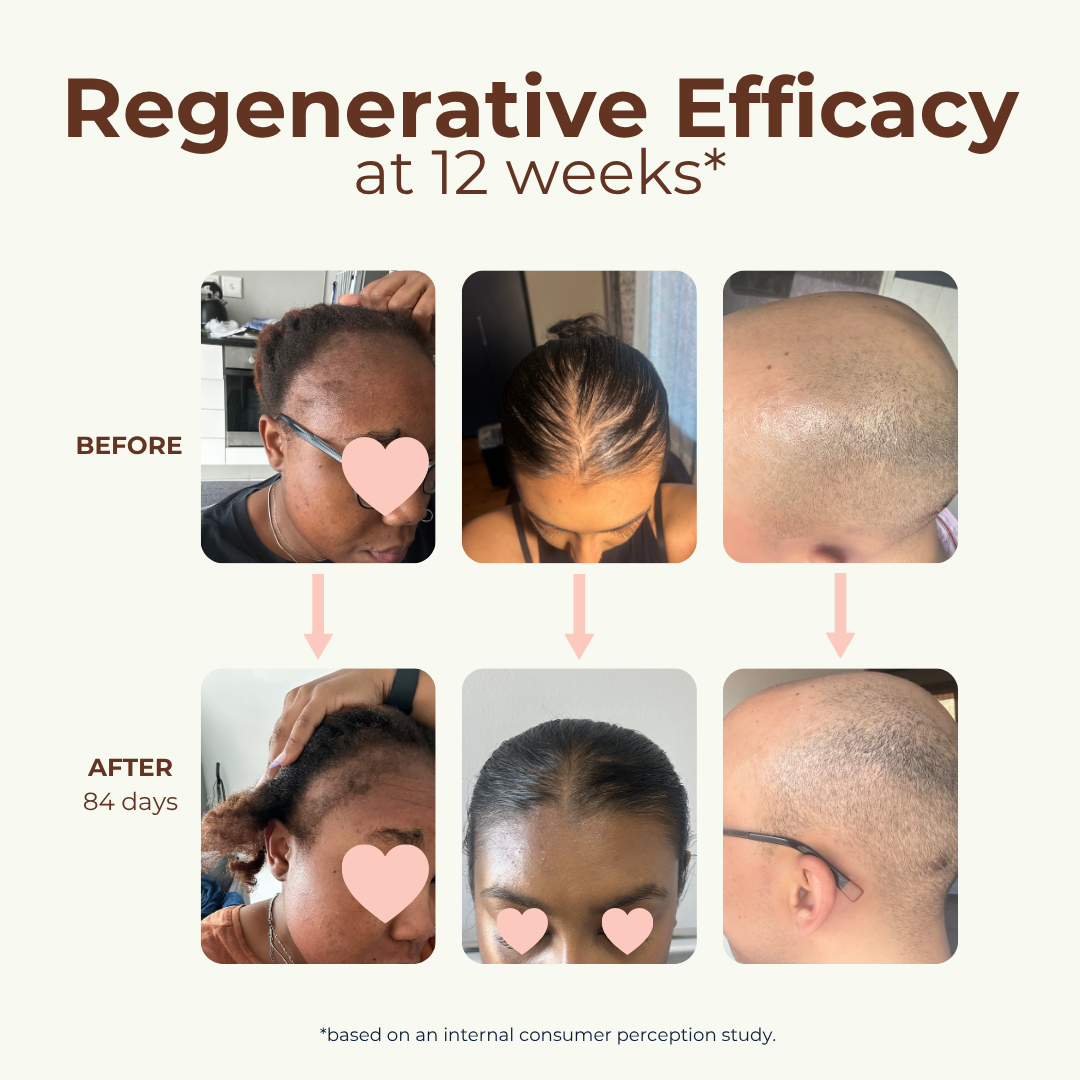 Peptide Miracle Hair Growth Serum with Rosemary Extract &amp; Plant-Stem-Cells