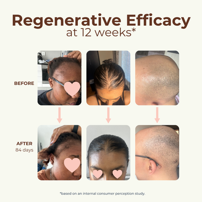 Peptide Miracle Hair Growth Serum with Rosemary Extract &amp; Plant-Stem-Cells