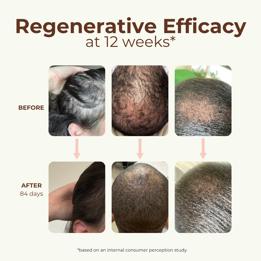Peptide Miracle Hair Growth Serum with Rosemary Extract &amp; Plant-Stem-Cells