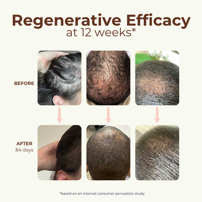 Peptide Miracle Hair Growth Serum with Rosemary Extract &amp; Plant-Stem-Cells