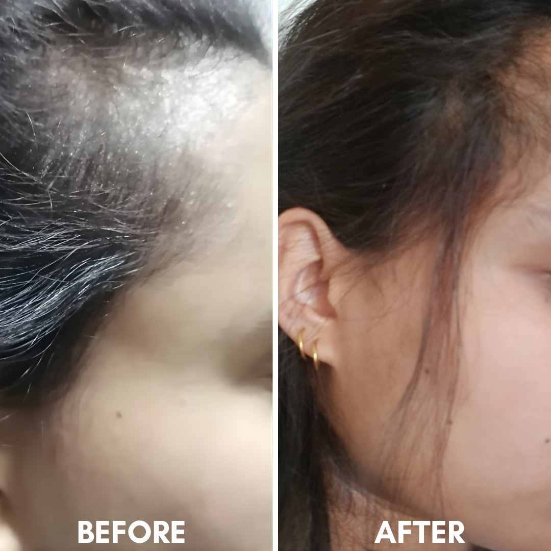 Hot Oil Hair Therapy with Rosemary, Castor &amp; Argan Oil