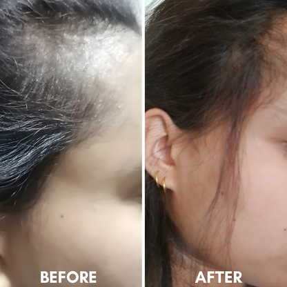 Hot Oil Hair Therapy with Rosemary