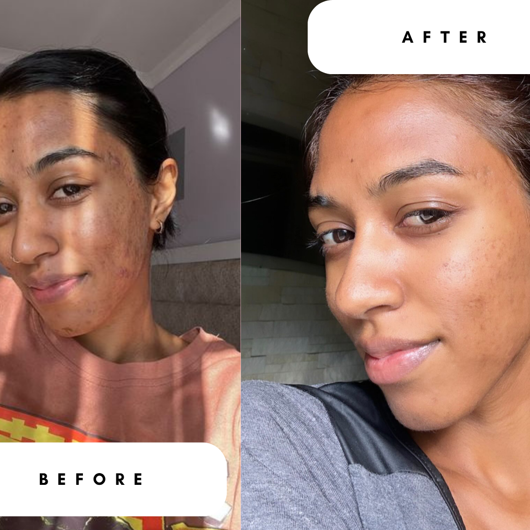 0,3% Advanced Retinol in 1% Hyaluronic Acid &amp; Niacinamide