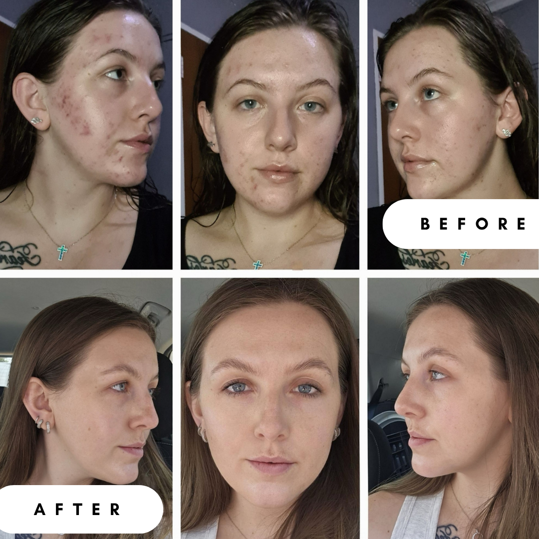 Hyaluronic Acid 1,5% &amp; Reneseed™ Peptides Serum (Retinol Alternative)