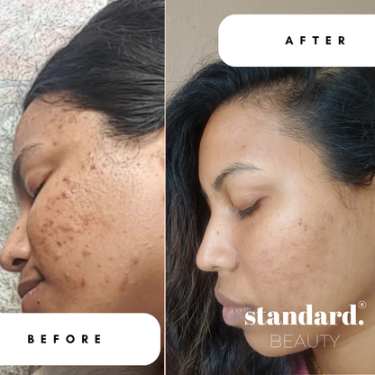 Retinyl Palmitate 1,5% (Vitamin A) Serum with Niacinamide &amp; Hyaluronic Acid