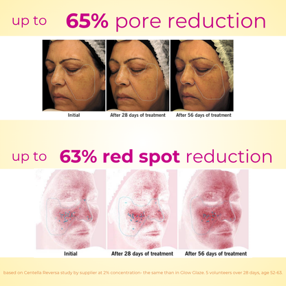Glow Glaze Serum with 2% Argireline® Amplified, 2% PDRN Centella Reversa™ Plant Stem Cells, 2% Ceramide, 2% Hyaluronic Acid