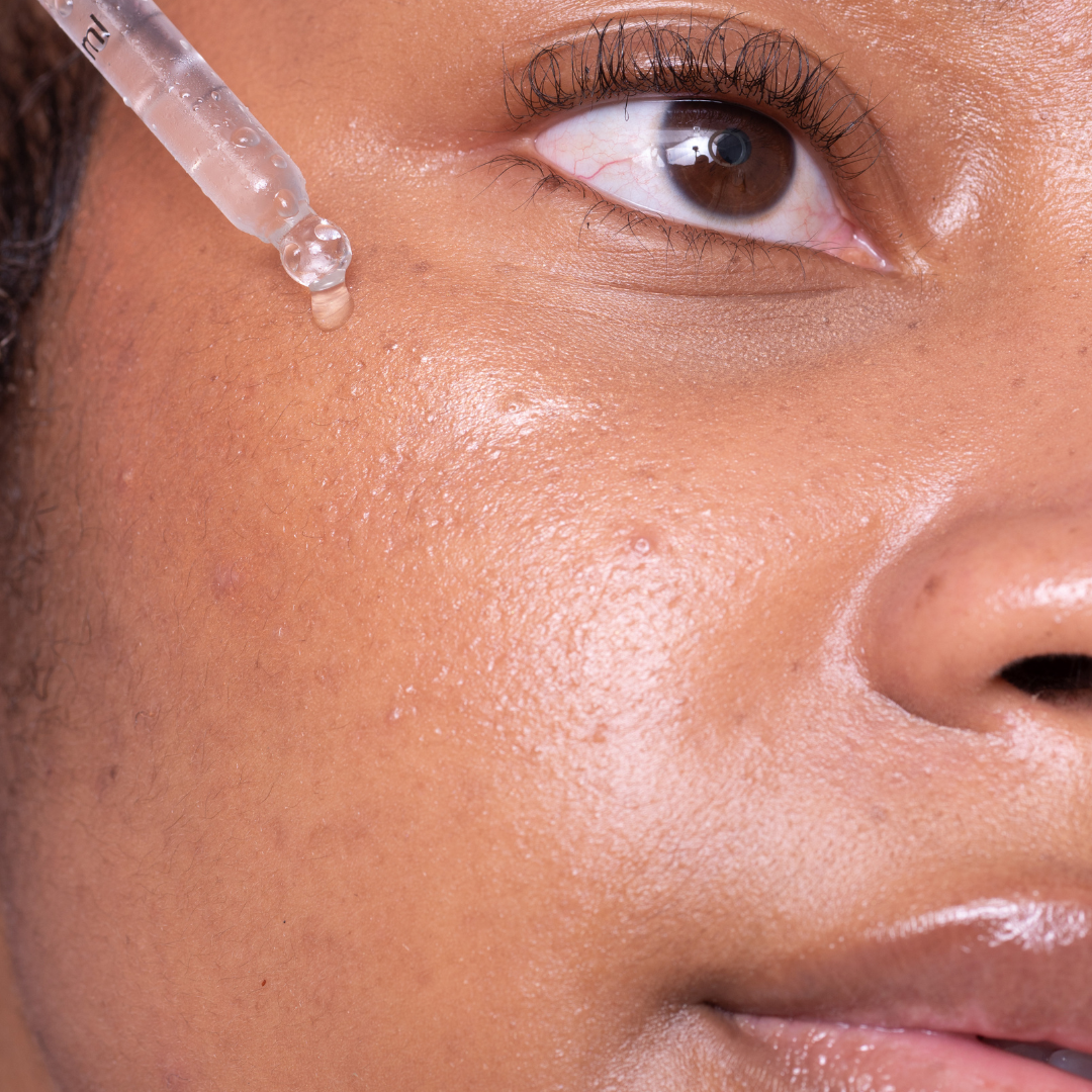 Oily &amp; Breakout Prone Skin Sets