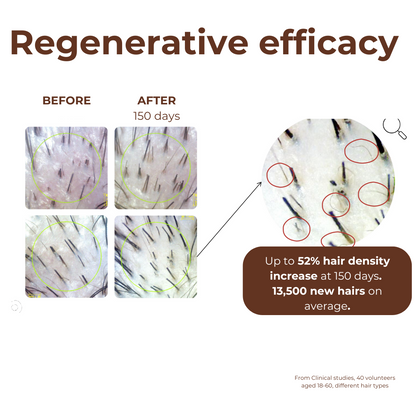 90 days Hair Growth Bundle: Hot Oil Hair Therapy with Rosemary Oil &amp; Peptide Miracle Hair Growth Serum