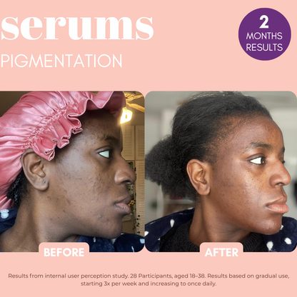 Pigmentation Buster Duo™ REFILL Oil-Phase