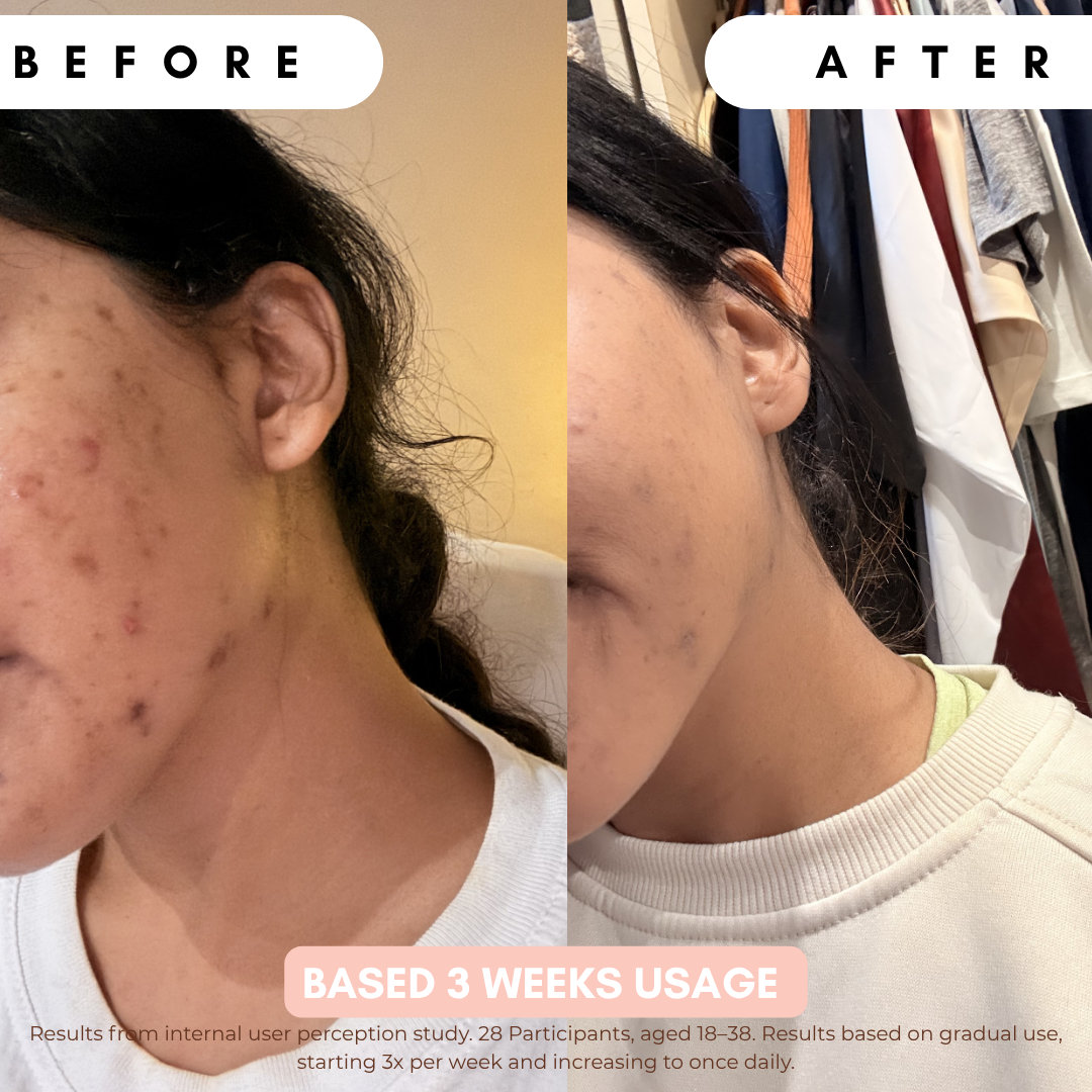 Pigmentation Buster Duo™ REFILL Oil-Phase