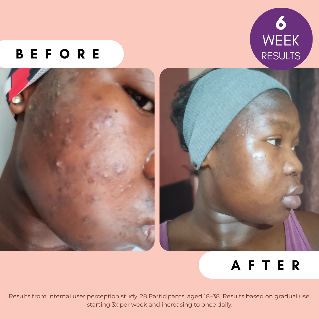 Pigmentation Buster Duo™ Dual Phase Brightening System