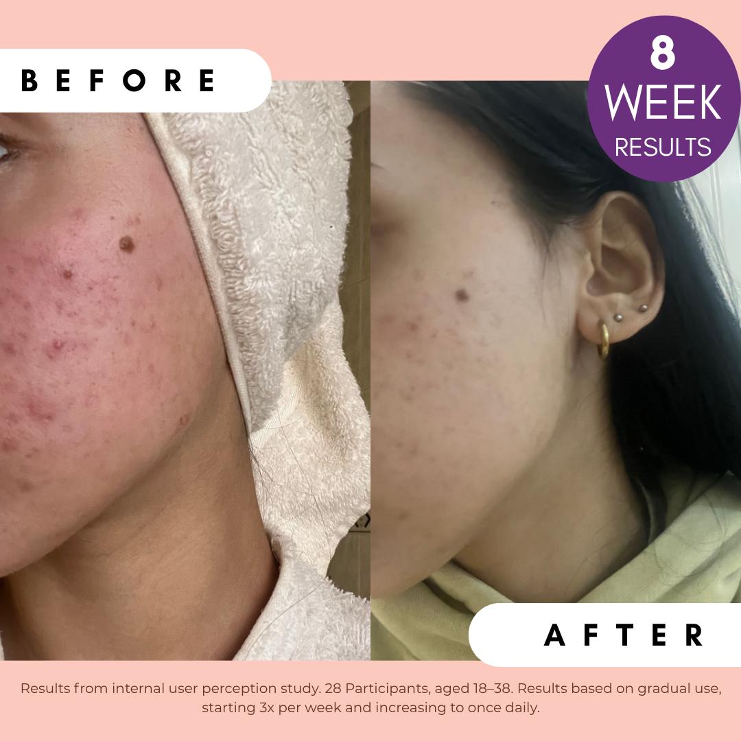 Pigmentation Buster Duo™ REFILL Oil-Phase
