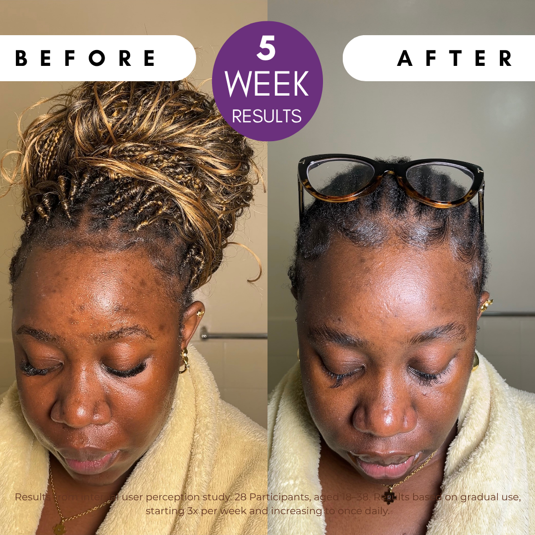 Pigmentation Buster Duo™ REFILL Oil-Phase