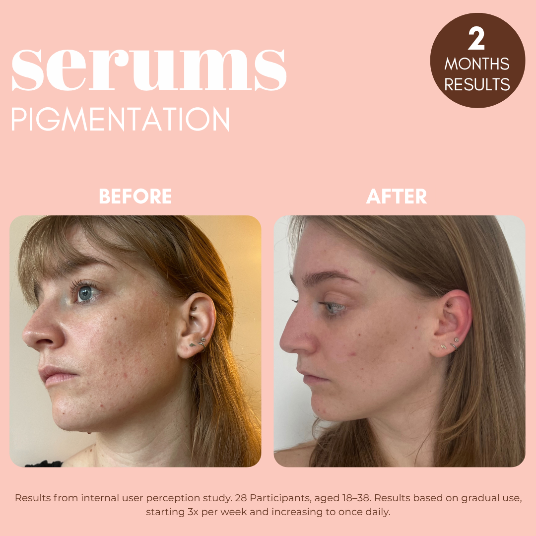 Pigmentation Buster Duo™ REFILL Oil-Phase