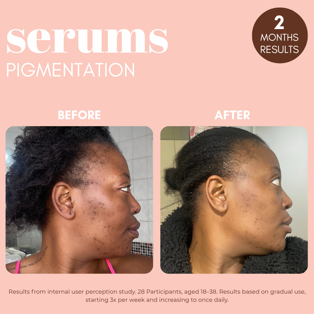 Pigmentation Buster Duo™ REFILL Oil-Phase