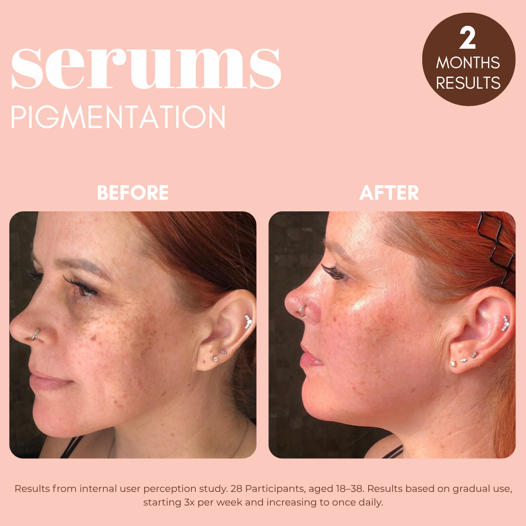 Pigmentation Buster Duo™ REFILL Oil-Phase