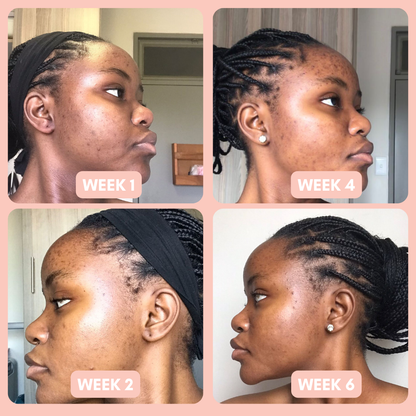 Pigmentation Buster Duo™ REFILL Oil-Phase