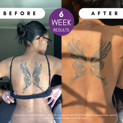 Pigmentation Buster ™ Tissue Oil with Bright Oleoactif® &amp; VF Lino®
