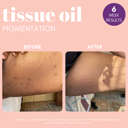 Pigmentation Buster ™ Tissue Oil with Bright Oleoactif® &amp; VF Lino®