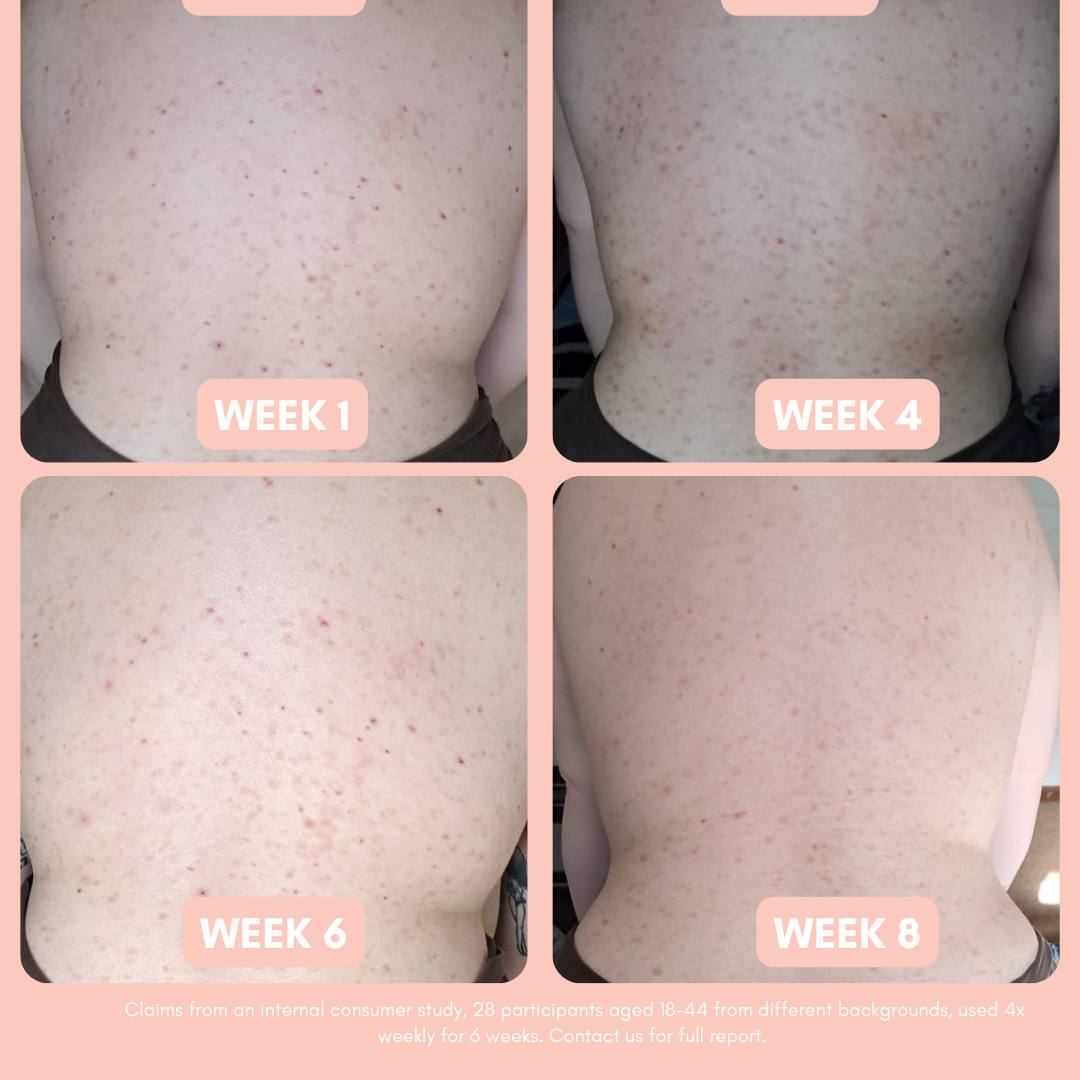 Pigmentation Buster ™ Tissue Oil with Bright Oleoactif® &amp; VF Lino®
