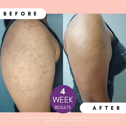 Pigmentation Buster ™ Tissue Oil with Bright Oleoactif® &amp; VF Lino®