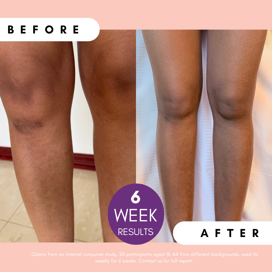 Pigmentation Buster ™ Tissue Oil with Bright Oleoactif® &amp; VF Lino®