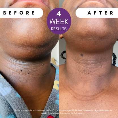 Pigmentation Buster ™ Tissue Oil with Bright Oleoactif® &amp; VF Lino®