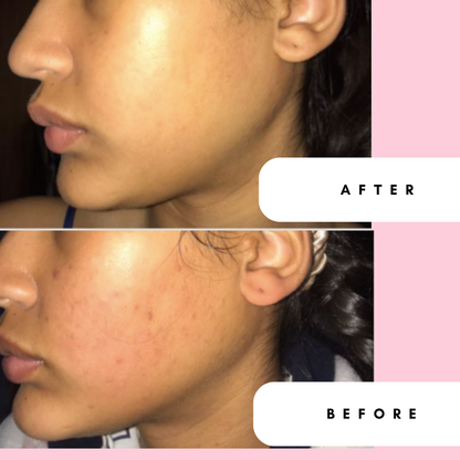 Moisture Bomb Daily Moisturiser with Rose, Aloe &amp; Cucumber