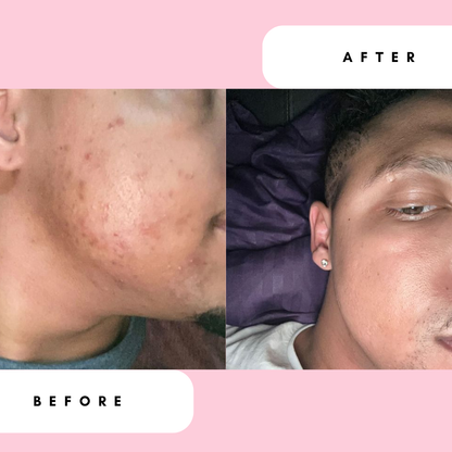 Moisture Bomb Daily Moisturiser with Rose, Aloe &amp; Cucumber