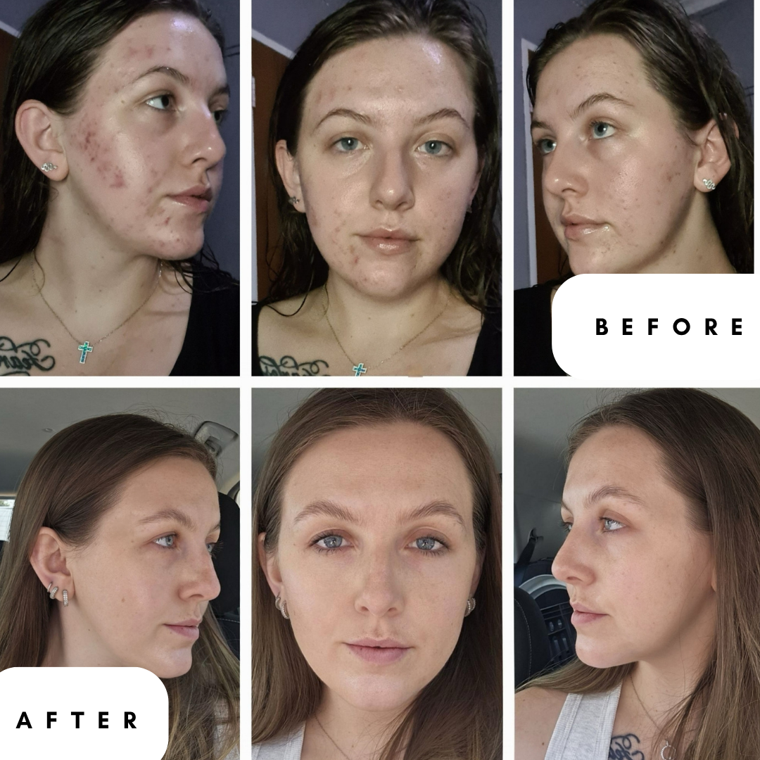 Glow Glaze™  Serum with 2% Argireline® Amplified, PDRN Centella Reversa™,  Ceramide, Hyaluronic Acid